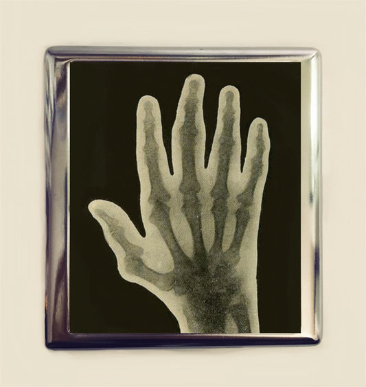 X-Ray Hand Cigarette Case Business Card ID Holder Wallet X Ray Medical Oddity Medicine