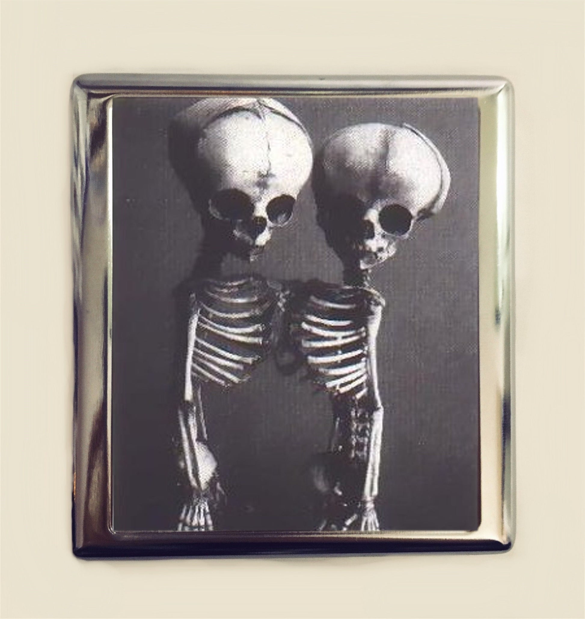 Siamese Skeletons Cigarette Case Business Card ID Holder Wallet Conjoined Twins Skeleton Medical Oddity Dark Art Goth Macabre